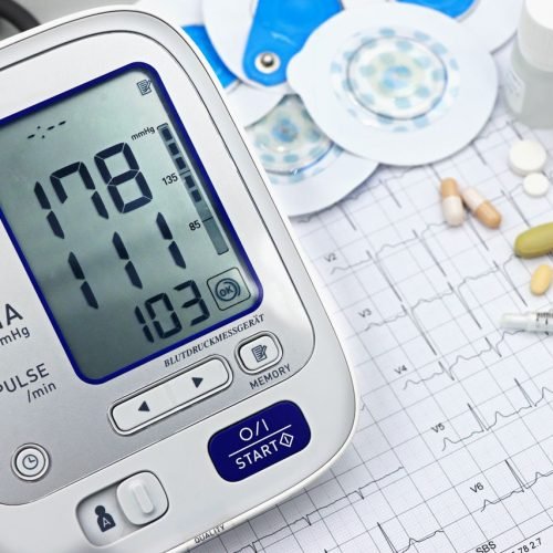 Close-up of a digital blood pressure monitor with ECG printout, pills, and medical tools.